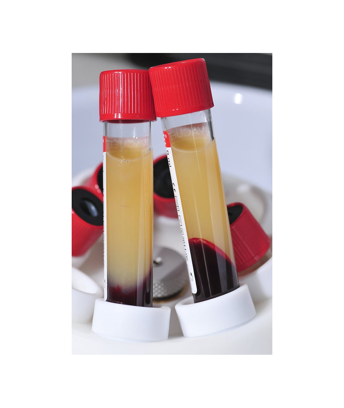 PRP Medifuge CGF